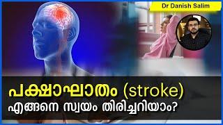 630പക്ഷാഘാതംStroke എങ്ങനെ സ്വയം തിരിച്ചറിയാം..How to swiftly recognise stroke by yourself.?