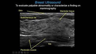 imaging Breast anatomy