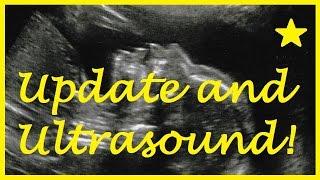 WEEK 20 Ultrasound First Child IVF Success