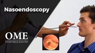 Nasoendoscopy Nose Examination - ENT