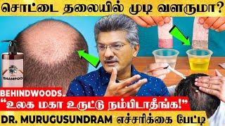 இது தெரியாம Shampoo Use பண்ணாதீங்க முடி மொத்தமும் கொட்டிடும் DR. MURUGUSUNDRAM பகீர் பேட்டி