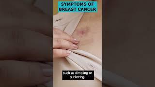 Breast Cancer Symptoms A 30-Second Guide  #ArtOfHealingCancer #30SecKnowledge #youtubeshorts