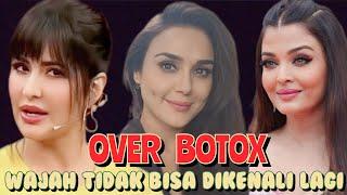 KELEBIHAN BOTOX WAJAH 7 ARTIS INDIA INI BERUBAH LAIN