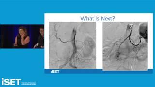 Hemorrhage Embolization Strategies and Techniques