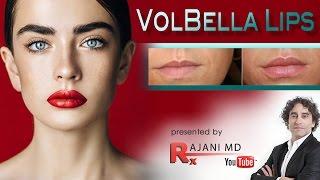 Volbella Lip Filler-Watch Dr Rajani