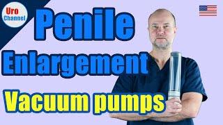Vacuum pumps for penile enlargement  UroChannel