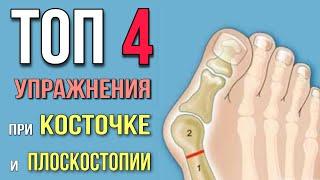 Топ-4 УПРАЖНЕНИЯ от КОСТОЧКИ на большом пальце ноги Hallux Valgus или ПЛОСКОСТОПИЯ