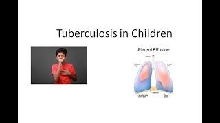 Pediatrics 251 Tuberculosis in Children Symptoms Diagnosis Treatment