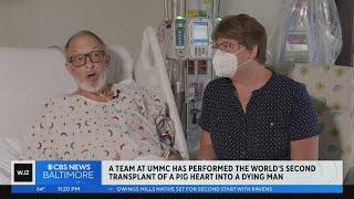 Maryland surgeons perform second pig heart transplant trying to save a dying man