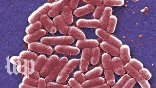 E. coli infections are gross. Here are 5 facts you cant unlearn about them.