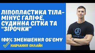 Антицелюлітний масаж який гарантовано прибере галіфе судинну сітку та зірочки на ногах.