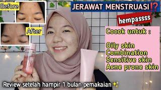 REVIEW PMS SERIES ADARA COSMETICS  Skincare Untuk Wajah Berjerawat & Sensitif