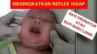 Meningkatkan Reflek Hisap Bayi Baru lahir atau Prematur. Pijat oromotor. Stimulate Suction Reflex