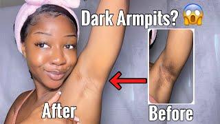 HOW TO LIGHTEN YOUR UNDERARMS WITH ONLY 1 PRODUCT - Fast and Effective treatment