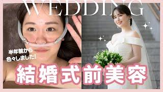 【本気美容】結婚式の半年前から綺麗になる為、本気出しました...！！