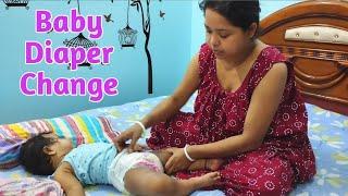 Tips for changing diapers of a baby Baby diaper change How to Change diaper of baby pamper change