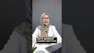 MATA BINTITAN SEPERTI INI CARA MENGATASINYA - dr. Nufus #matabintitan #obatbintitan