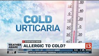 Allergic to cold is a medical condition