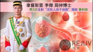 YH DATO’ SRI RYOJP 拿督斯里李傑局绅博士 - 第3次注射活性干细胞揭晓逦爵的“黑科技”疗法 Revealing REJUV Technology StemCells Therapy