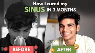 7-Year Old Sinus Problem Gone in 3 Months  Sinus Treatment at Home