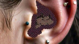 ASMR left side ear treatment removal insect infected ear  ASMR severely affected by ear ASMR