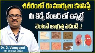 కిడ్నీ పాడయ్యే ముందు లక్షణాలు  How to Diagnose Kidney Problems in Telugu  Sriraksha Hospital