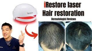 iRestore laser hair restoration Dermatologist Reviews