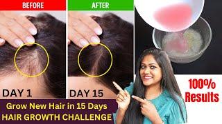 OMG - 15 Days Hair Growth Miracle Treatment  Grow Long Thick hair  100% Works