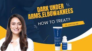 Dark underarms elbows and knees  How to treat  Dermatologist recommends  Be Bodywise Review