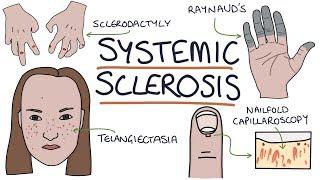 Systemic Sclerosis and Scleroderma Visual Explanation for Students