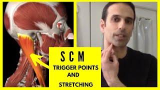 Dizziness headaches and neck pain from SCM trigger points