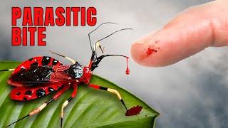 ASSASSIN BUG puts me in the Hospital