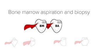 Bone Marrow Biopsy & Aspiration BMBx