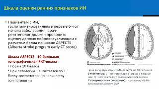 Диагностика ишемического инсульта