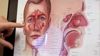 Diagnosing Sinus Infections