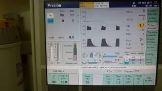019 CURVAS DE FLUJO VOLUMEN PROGRAMADO EN MODO PRESION CON Y SIN PEEP