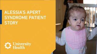 Alessias Story  Apert Syndrome Patient Story