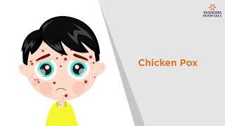 Chicken Pox Symptoms Causes Prevention and Treatment  Yashoda Hospitals