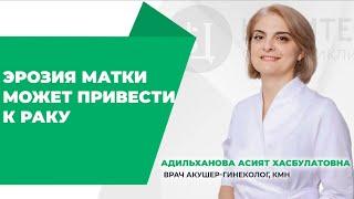 ЭРОЗИЯ МАТКИ МОЖЕТ ПРИВЕСТИ К РАКУ 