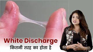 सफ़ेद पानी के कारण इलाज और बचाव  White Discharge in Women Causes Symptoms and Prevention 