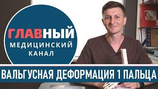 Косточка на ноге у большого пальца болит что делать. Вальгусная шишка на большом пальце ноги