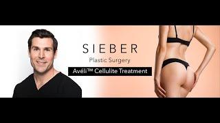 Aveli cellulite treatment- David Sieber M.D. Plastic Surgeon in San Francisco Bay Area