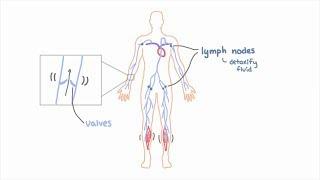 Lymphedema  Explained
