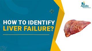 How to Identify Liver Failure ?  Dr. Anand Ramamurthy Liver Transplant surgeon  Apollo Hospitals