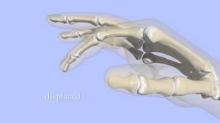 Percutaneous Pinning Finger Tip