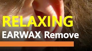 5 min Relaxing Earwax Removal for sleep