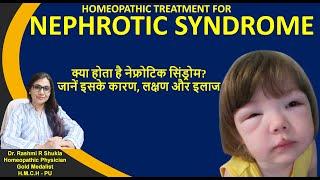 Nephrotic Syndrome Treatment  नेफ्रोटिक सिंड्रोम कारण लक्षण और होम्योपैथिक इलाज