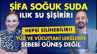 Annene Olan Öfken ve Kırgınlığın İyileşmeden KİLO VEREMEZSİN Göbeğinin İçinde O Duygu Var #reklam