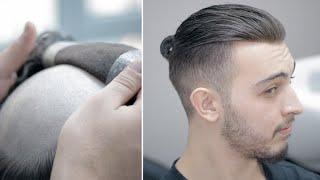 PROTEZ SAÇ - Bağlama Modeli - Hair Replacement