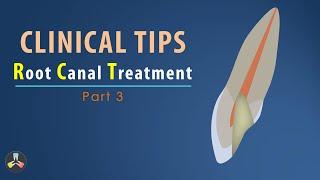 Root Canal Treatment  Clinical tips  Part 3